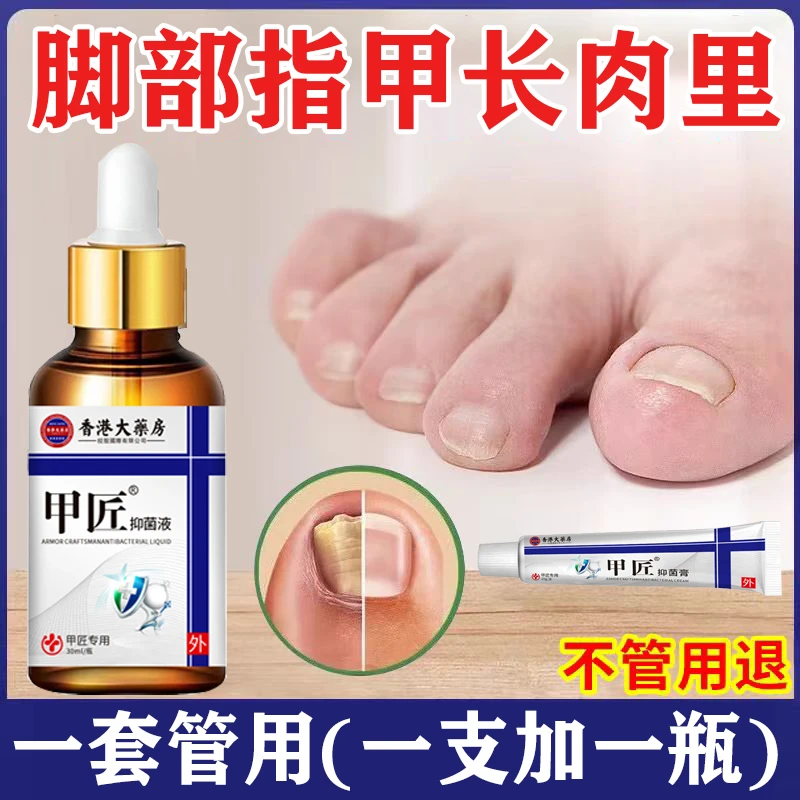 甲匠趾甲专用抑菌液快速修复坏甲草本萃取外用脚部抑菌液加乳膏
