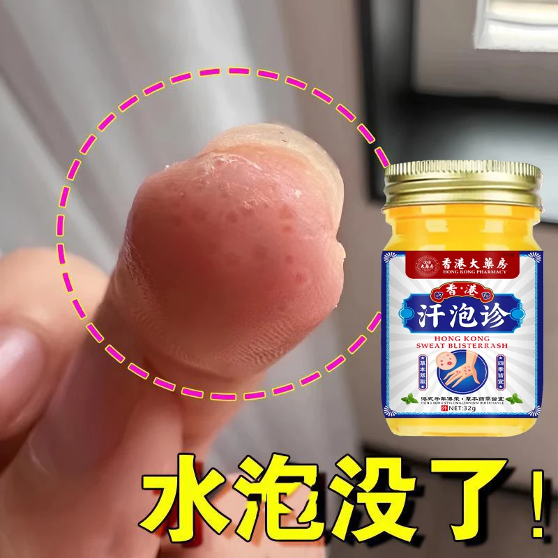 汗诊泡手上起小水泡止痒膏脱皮抑菌克星手指缝痒干裂专用草本乳膏