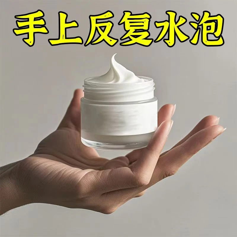 手脚水泡抑菌乳膏止痒膏草本配方皮肤干痒干裂手脚起水泡真菌感染