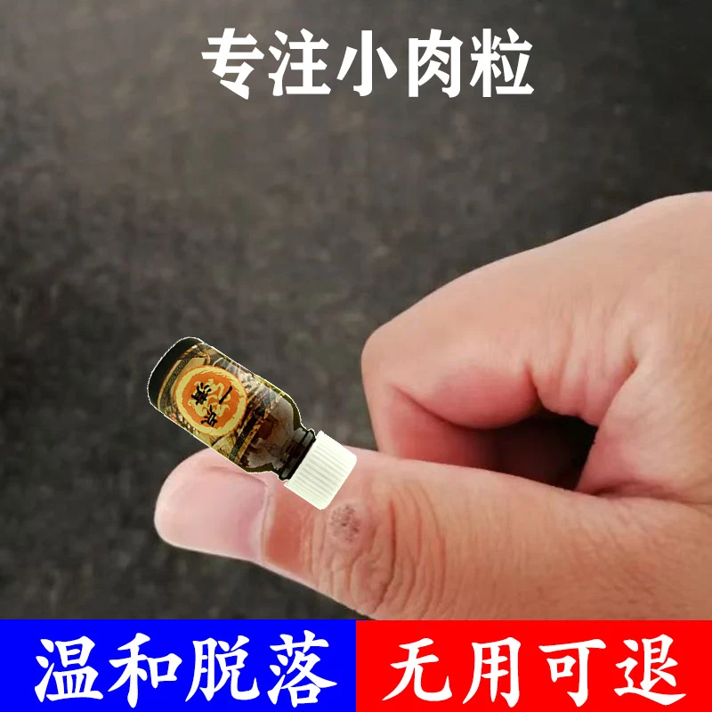 手上长疙瘩刺瘊子手指肉刺球手足凸起寻常疙瘩粗糙肉钉温和外用液