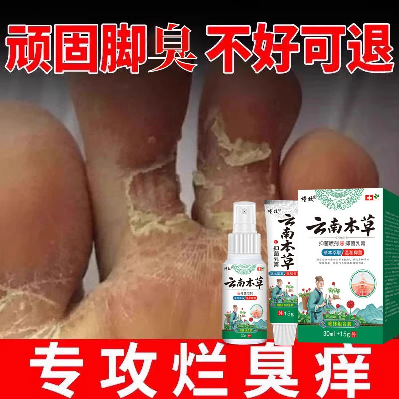 脚趾缝烂痒专用脚痒脚臭止痒神器脚丫脱皮抑菌膏开裂克星喷雾剂