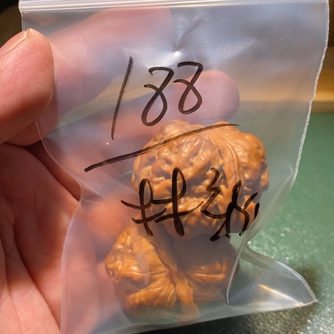 吊坠桃核林*蛤蟆眼中只见她