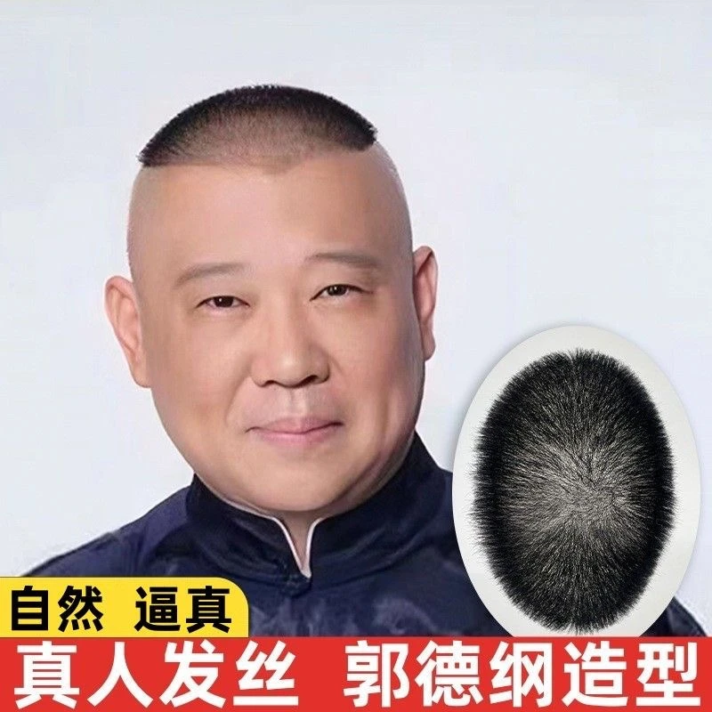 生物头皮男士假发片郭德钢发型光头男假发真发头顶补发块寸头大哥