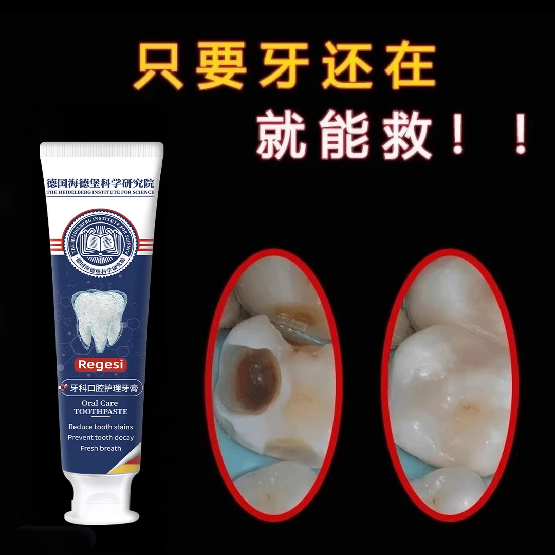 【德国研究院】蛀牙专用牙膏牙黄牙黑敏感大牌护理牙膏