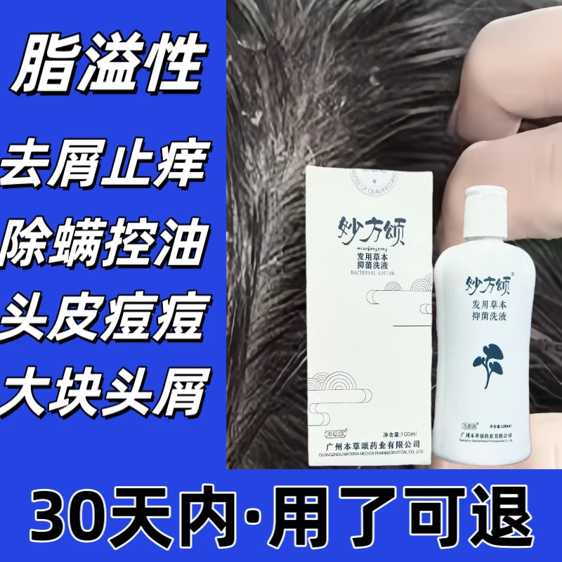 头皮脂溢性洗发水除螨控油去大块头屑严重去屑止痒秒方颂抑菌洗液