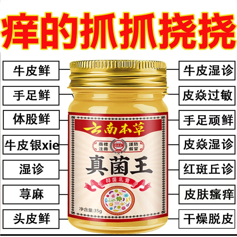 云南真菌王快速止痒皮肤瘙痒外用全身干痒止痒膏手脚瘙痒特效抑菌