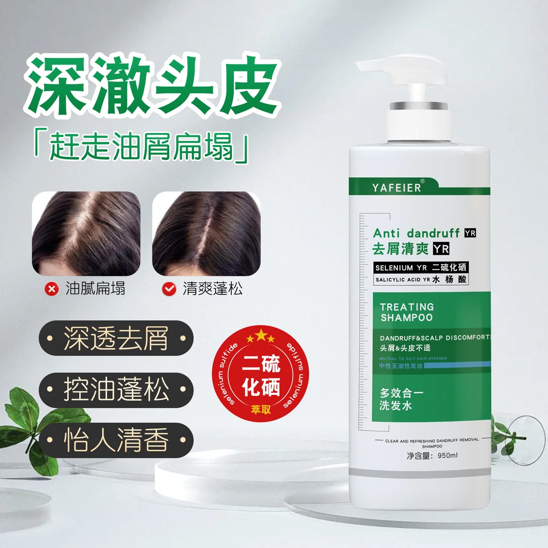 二硫化硒洗发水除螨控油蓬松去屑止痒水杨酸洗头男女持久留香CC