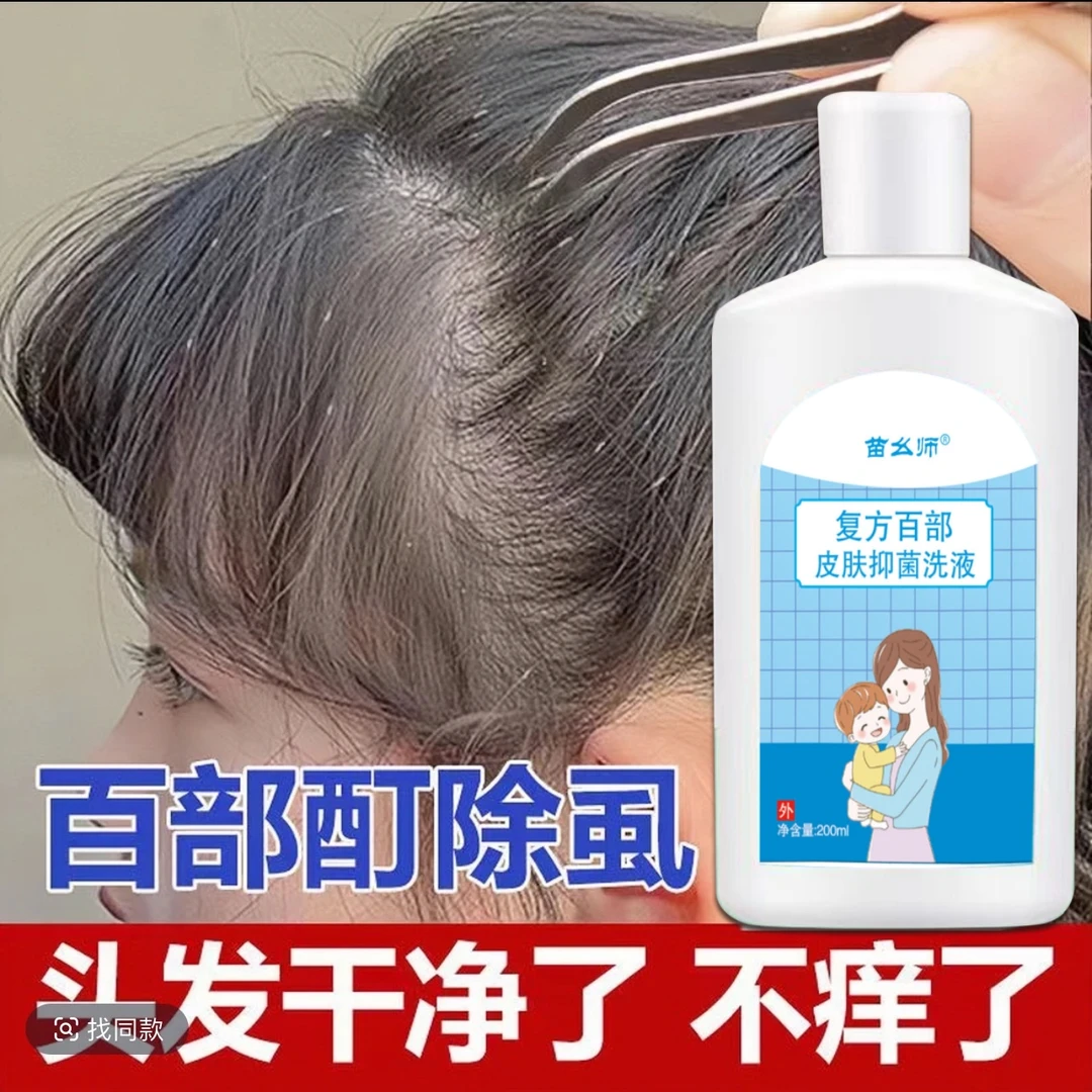除虱洗发水头上长虱子的药学生头发虱立净小女孩头虱去除虫卵双杀