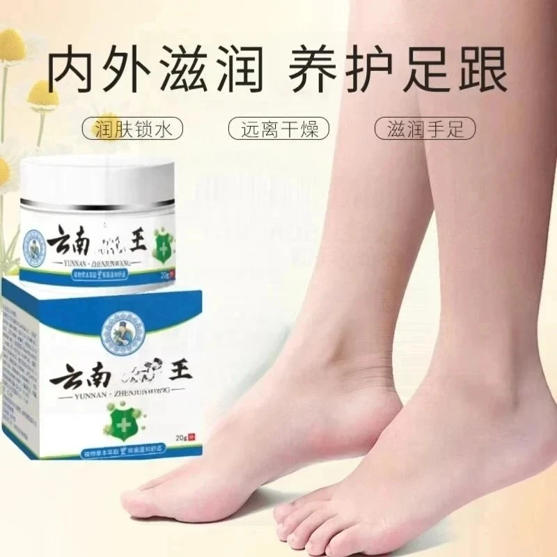 正品云南真菌王脚后跟起皮粗糙干裂起硬皮手开口干裂防裂膏