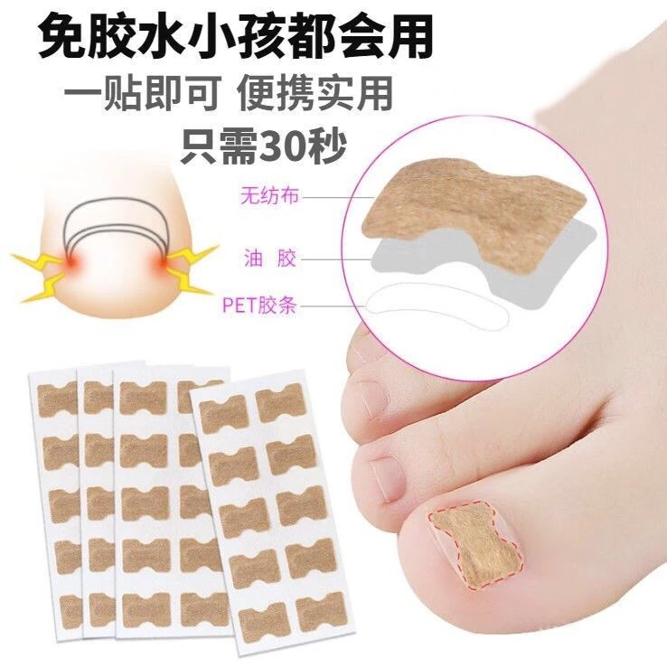 甲沟炎矫正神器正甲贴脚趾甲专用矫正器贴片指甲长肉里脚拉拉贴