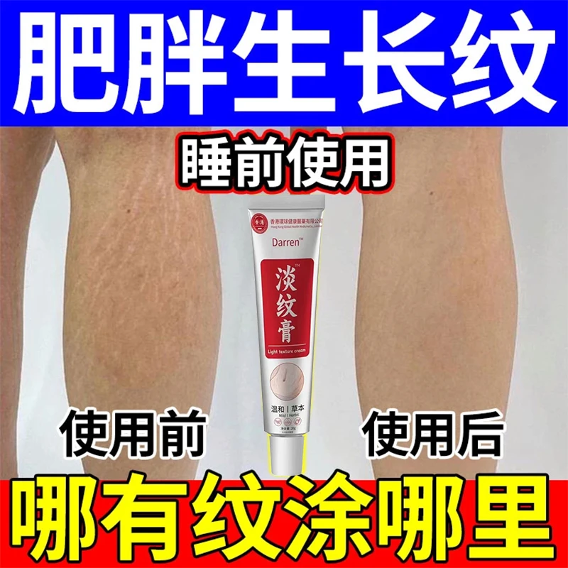 肥胖纹生长纹大腿学生腰腹上肥胖纹淡纹膏产后纹肚皮纹霜油乳