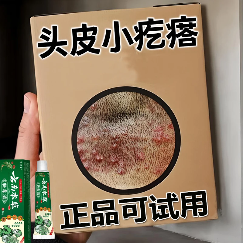 头上有疙瘩豆豆专用毛i囊堵i塞头皮草本萃取痒红i肿毛囊全身通用