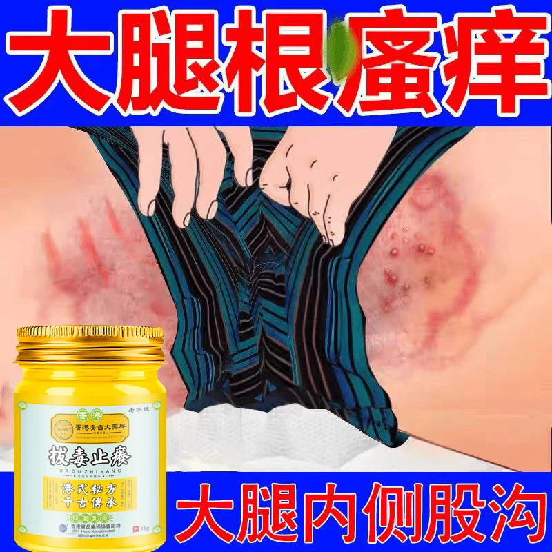 大腿内侧瘙痒越抓越痒大腿和睾丸夹缝处潮湿异味外用止痒抑菌软膏