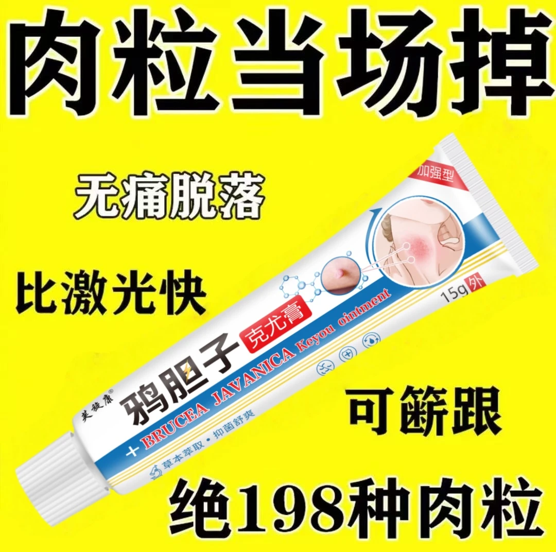 【小肉粒专用】鸦胆子克尤膏去脖子肉粒手足腋下丝状扁平肉刺乳膏