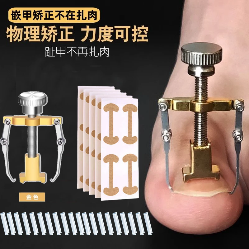 甲沟炎矫正神器指甲矫正器脚指甲往肉里长怎么办专用正甲隔离垫片