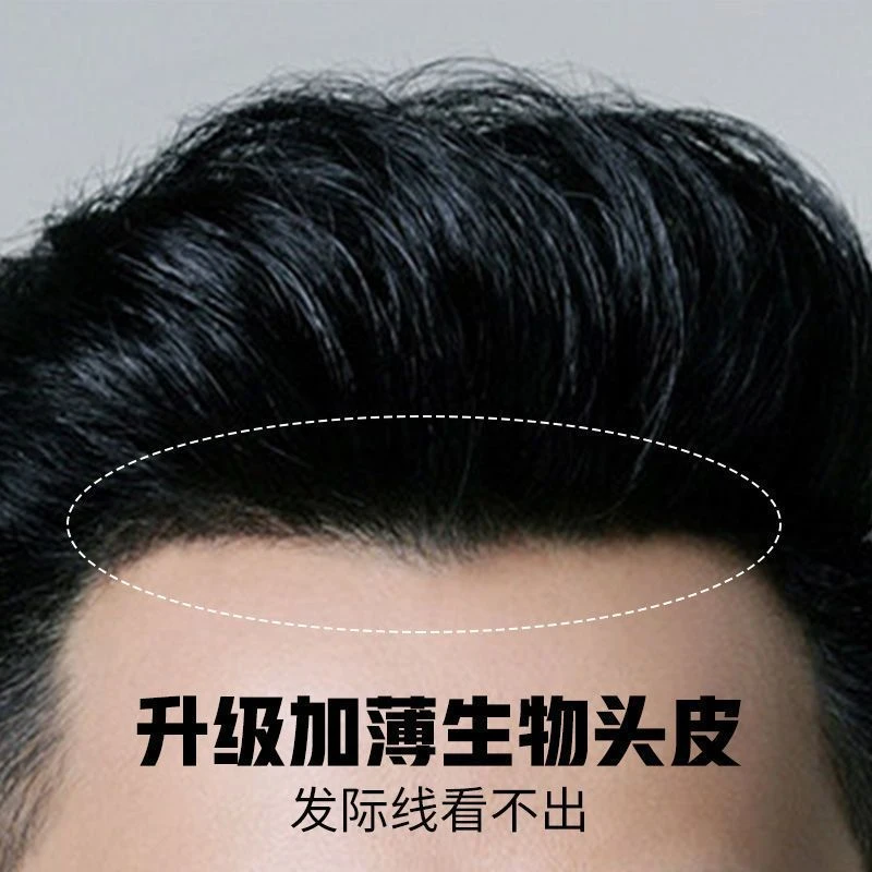 发际线假发贴男士前额无痕补发片真发隐形生物头皮M型额头刘海片