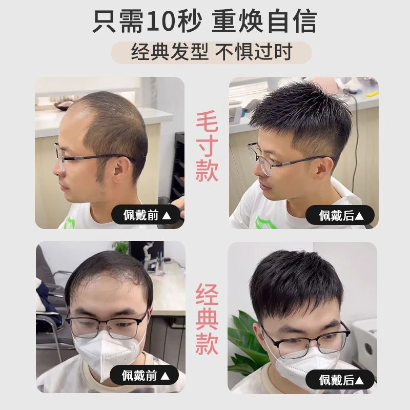 新款帅气男士假发补发片头顶补发真人发丝超轻薄透气无痕隐形批发