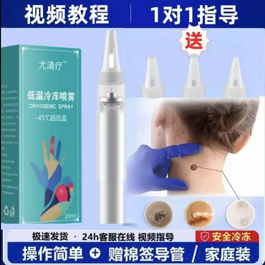 液氮冷冻喷雾低温喷雾祛尤喷雾丝状寻常扁平跖