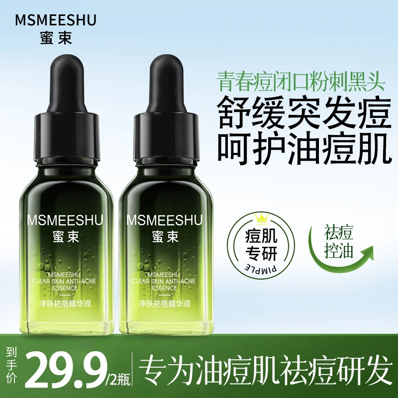 【拍一发二】蜜束小绿瓶祛痘精华液控油净肤改善黑头粉刺呵护痘肌*S