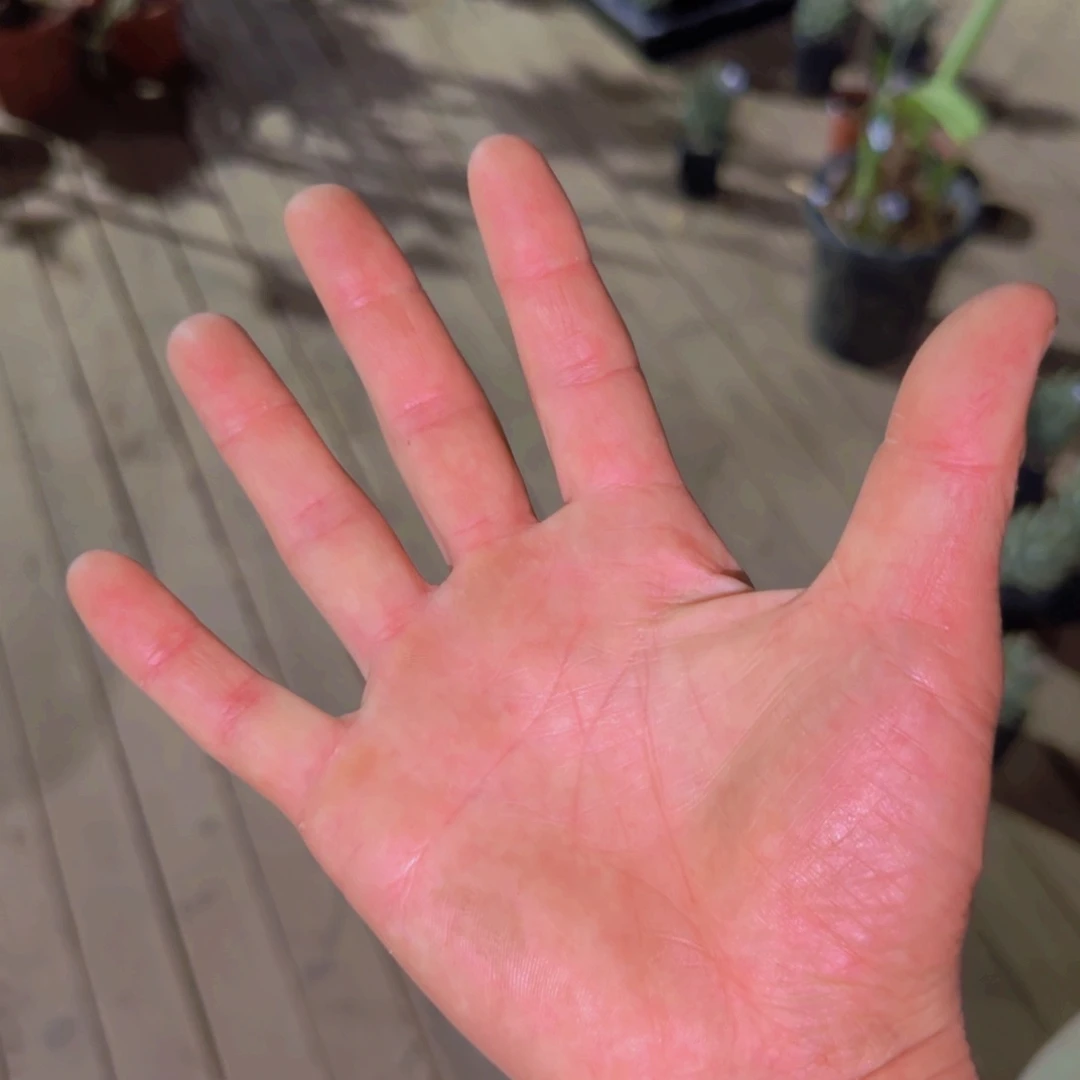 刘*力索马里大戟索马里大戟