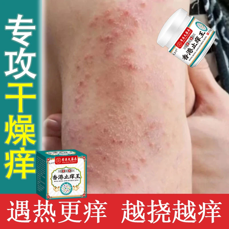 皮肤湿痒止痒季节性瘙痒红肿硬疙瘩全身痒起皮干痒草本外用乳膏