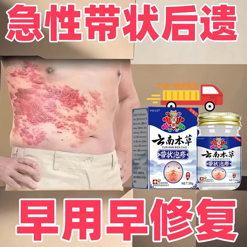 带状泡疹后遗神经痛专用膏蛇盘疮疱疹清病毒缠腰龙蛇胆疮膏