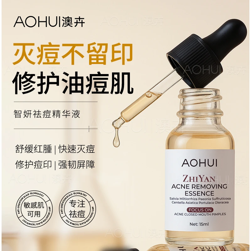 AOHUI/澳卉【痘痘闭口粉刺黑头】智妍祛痘精华液15ml