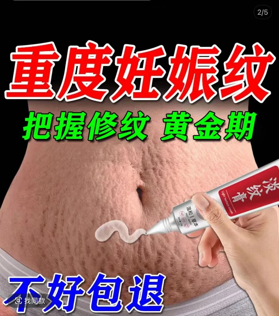 妊娠纹修复霜孕产妇产后消除紧致淡纹肥胖纹祛除膏妊纹外消除神器