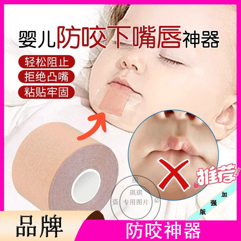 防吸下嘴唇神器宝宝儿童睡觉戒咬嘴唇宝宝咬下嘴唇矫正神器