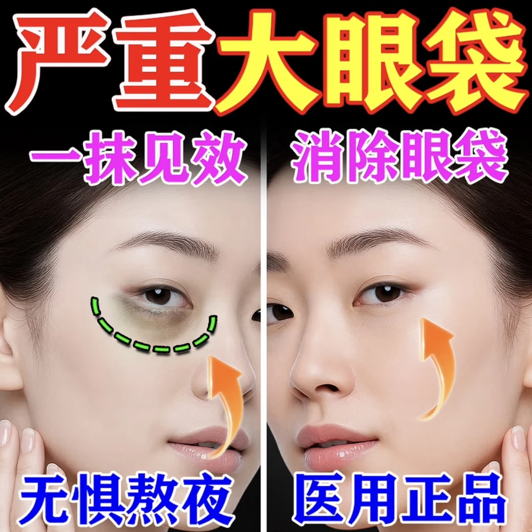【消除眼袋】顽固眼袋黑眼圈眼睛浮肿庐岛制药草本眼袋膏一抹就没