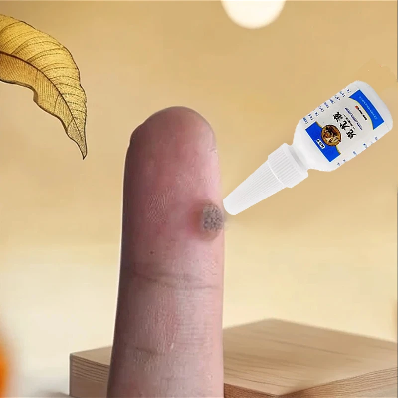 【快速掉落】全身皮肤手脚上袪尤克星脚底肉刺鸡茧草本植物精华涂抹
