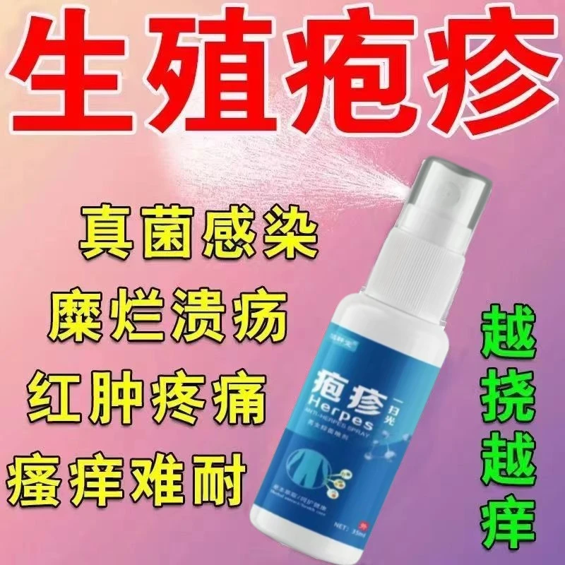 生殖疱疹喷剂蛇盘疮后遗症神经痛痒去痛蛇胆疮抑菌草本身体护理喷