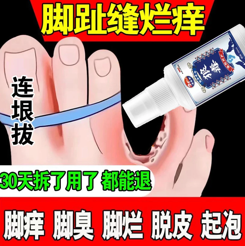 狼毒脚部痒脱皮脚起水泡防臭清新止痒抑菌脚部去臭植物萃取喷雾剂