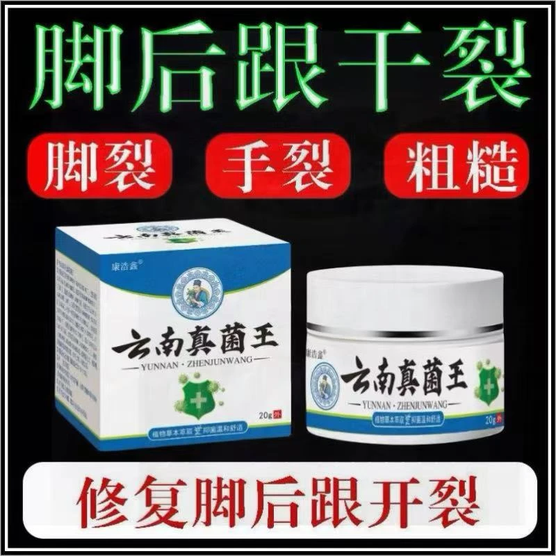 云南真菌王脚后跟干裂起硬皮粗糙脚底板脱皮干皲裂膏起厚皮神器膏