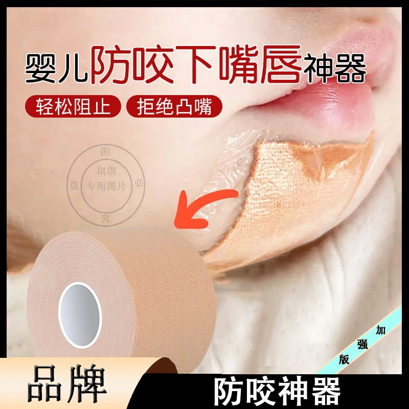 防吸下嘴唇神器宝宝儿童睡觉戒咬嘴唇宝宝咬下嘴唇矫正神器