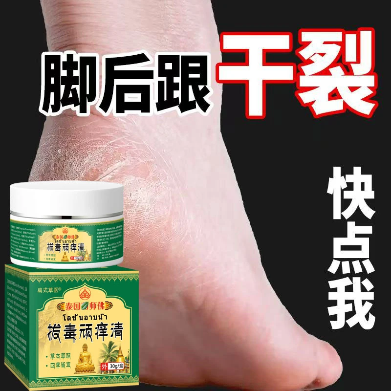 拔毒顽痒清脚后跟开裂秋冬季神器防裂膏手足干裂痒真菌感染抑菌膏