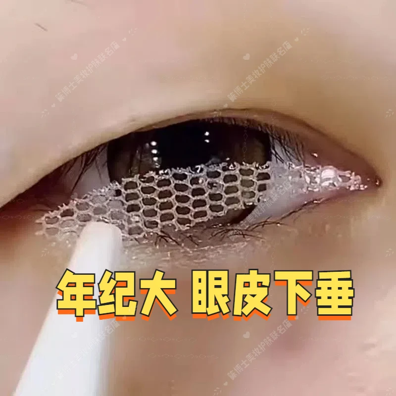 【年纪大眼皮下垂】蕾丝隐形双眼皮贴隐形美目贴护肤神器防水镂空