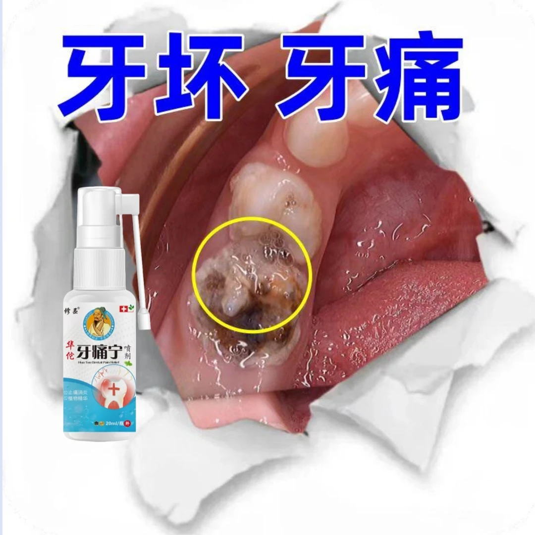 牙痛牙疼止疼专用药水喷雾剂宁杀死牙神经蛀牙智齿牙龈肿痛的特效