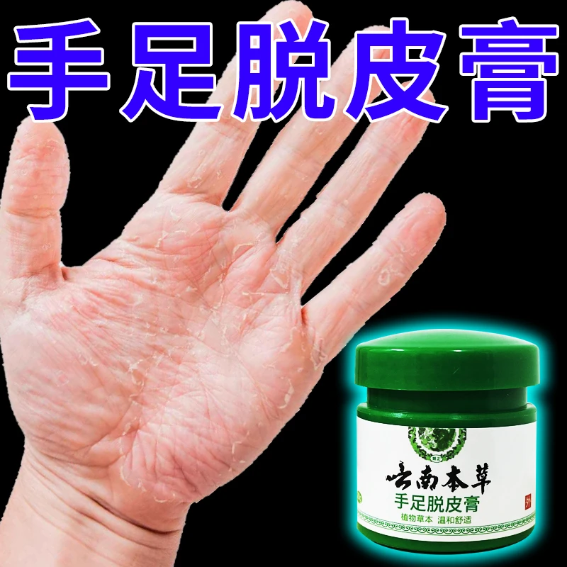 云南本草膏手足脱皮膏草本精粹外用手脚部脱皮干裂抑菌止痒干软膏