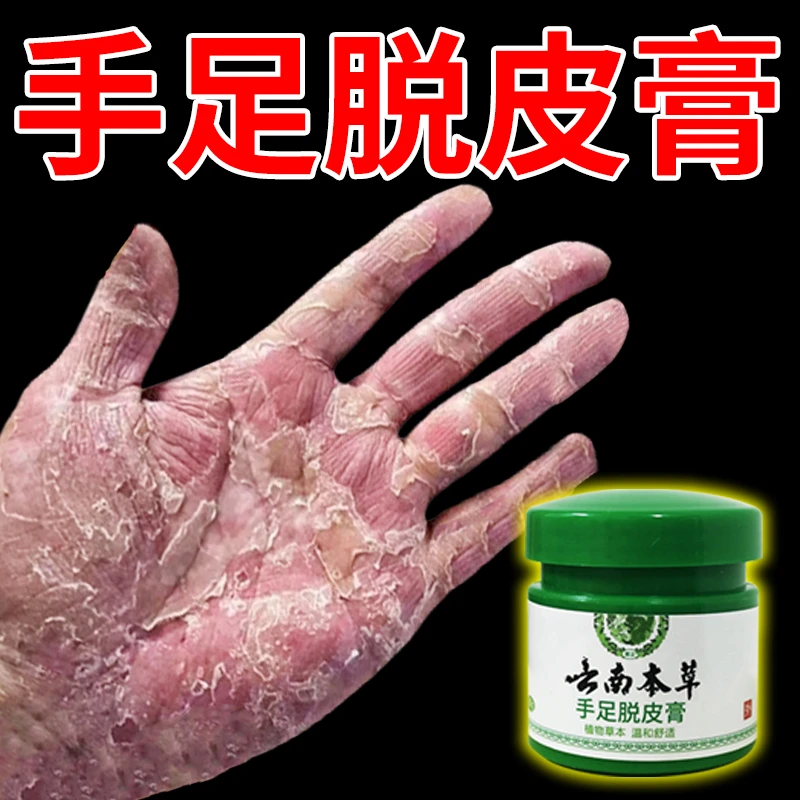 云南本草手足脱皮膏20g/盒 草本萃取涂抹温和外用手脚部脱皮干裂