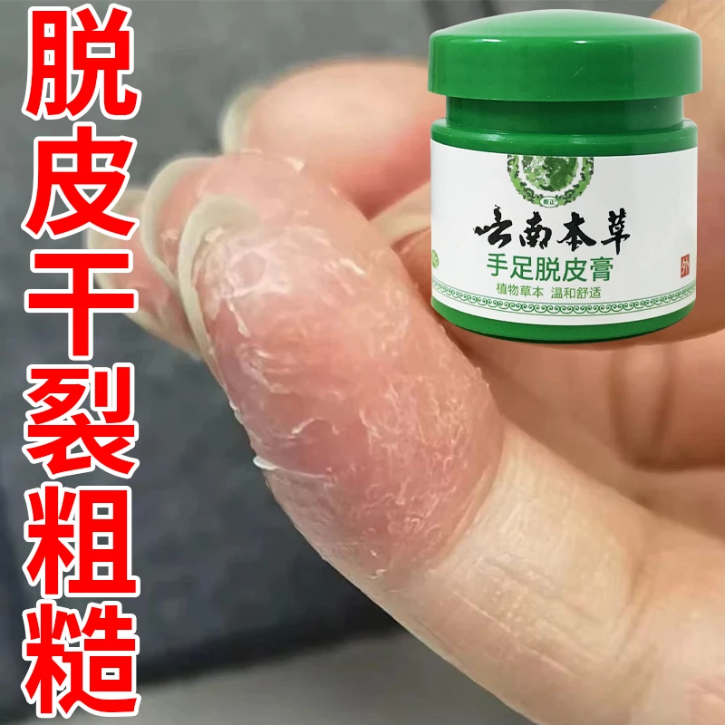 云南本草手足脱皮膏20g/盒 草本萃取涂抹温和外用手脚部脱皮干裂