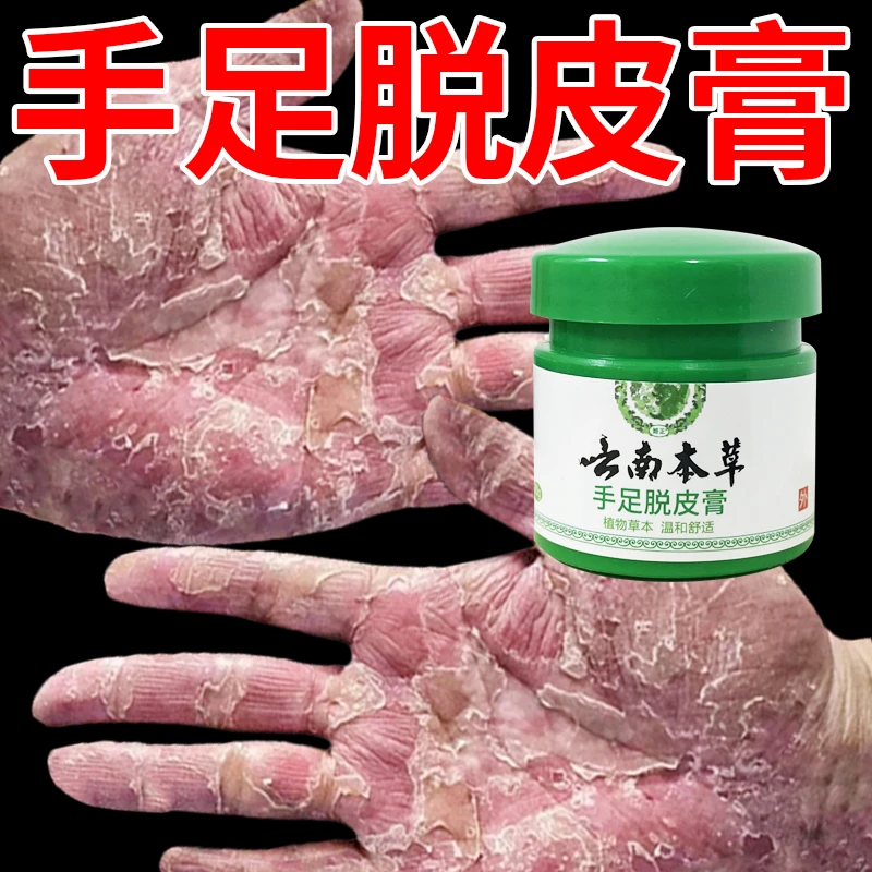 云南本草手足脱皮膏20g/盒 草本萃取涂抹温和外用手脚部脱皮干裂