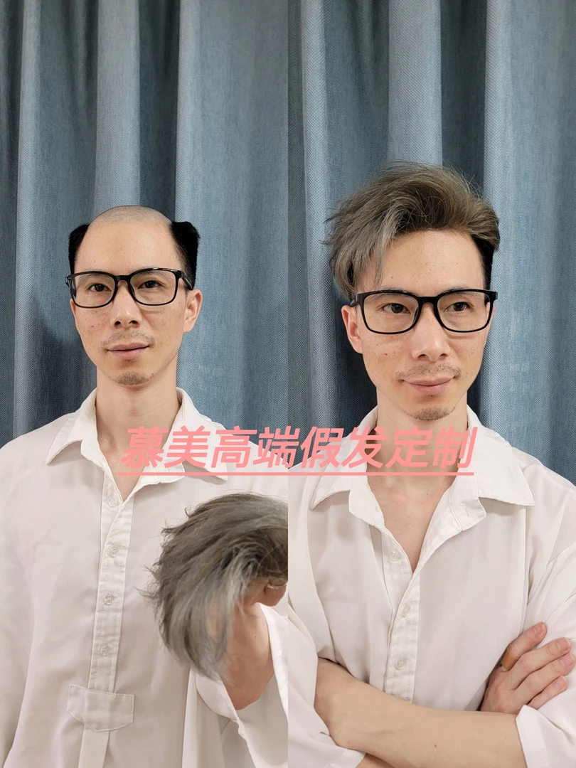幕美增发补发 假发定制