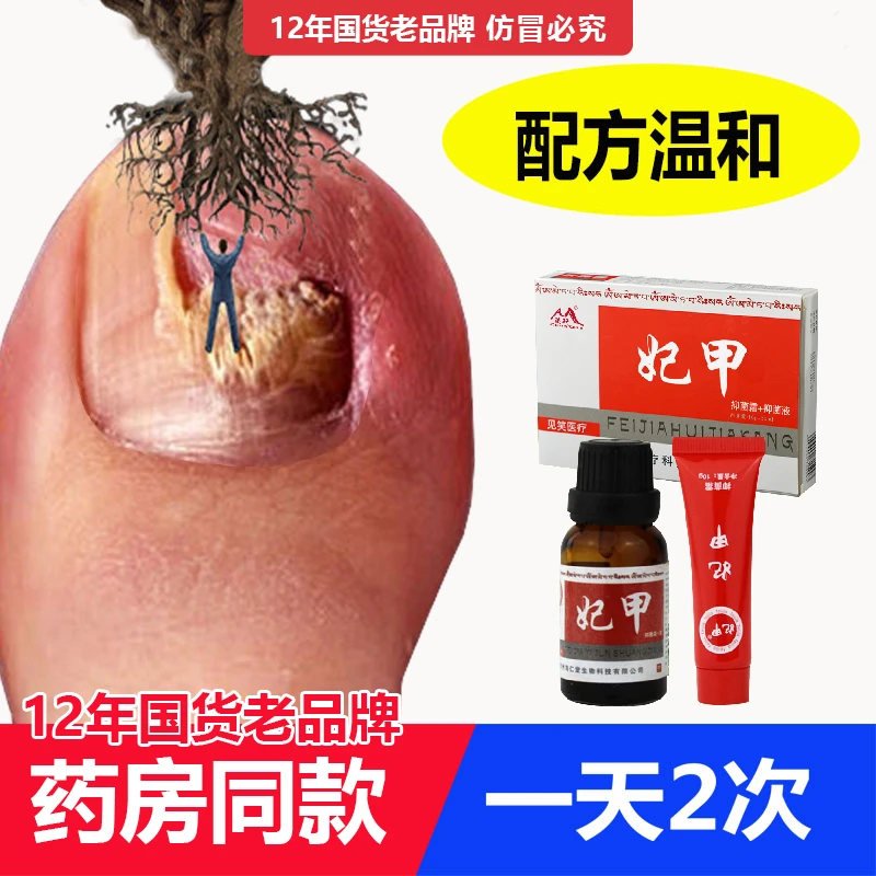妃甲液手指甲空坏甲净厚黄甲脱甲沟炎修护阿莫罗芬.妃甲搽剂外用