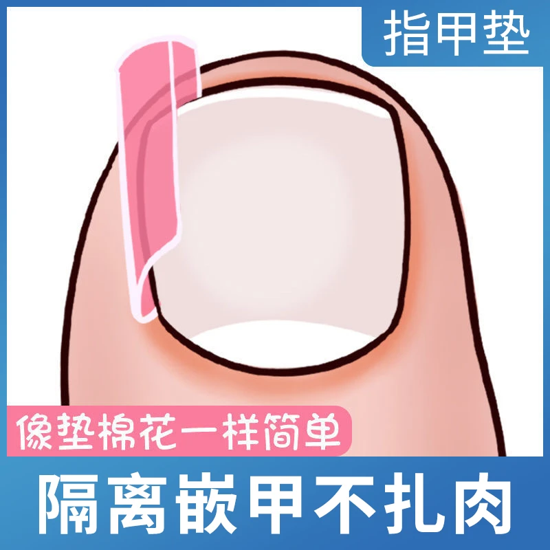 甲沟神器指甲矫正器嵌甲专用隔离填充垫片脚趾甲炎往肉里长纠正甲