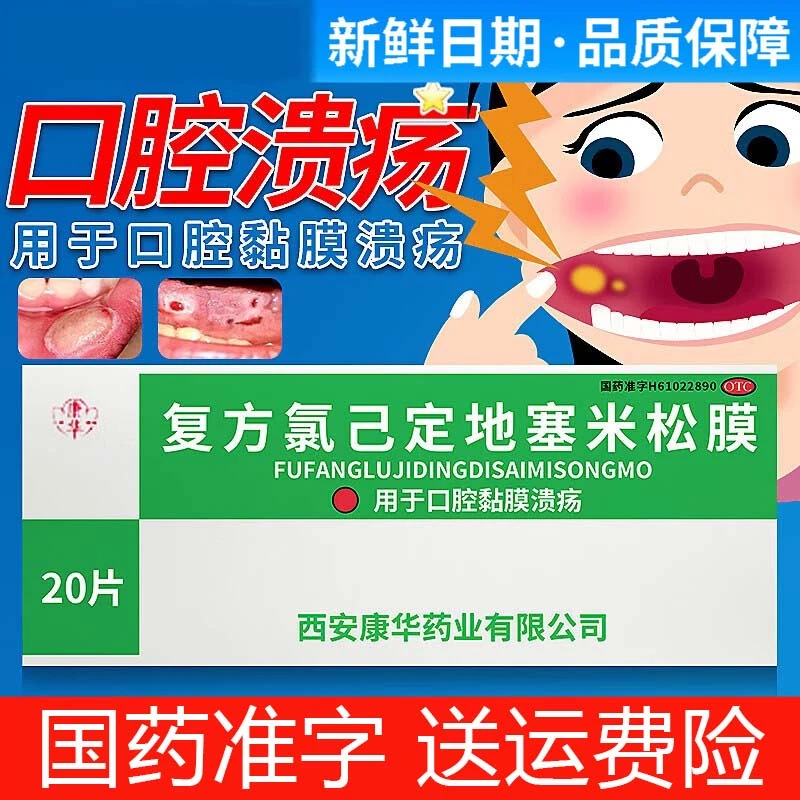 KANGHUA/康华口腔溃疡贴片复方氯己定地塞米松膜20片治疗口腔黏膜溃疡贴片仅口腔使用