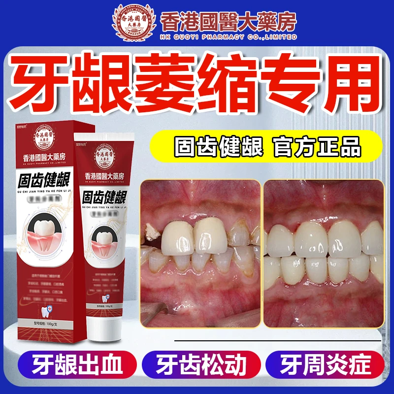 牙龈萎缩专用牙膏牙龈修复神奇牙根暴露牙齿松动牙缝宽护龈固齿