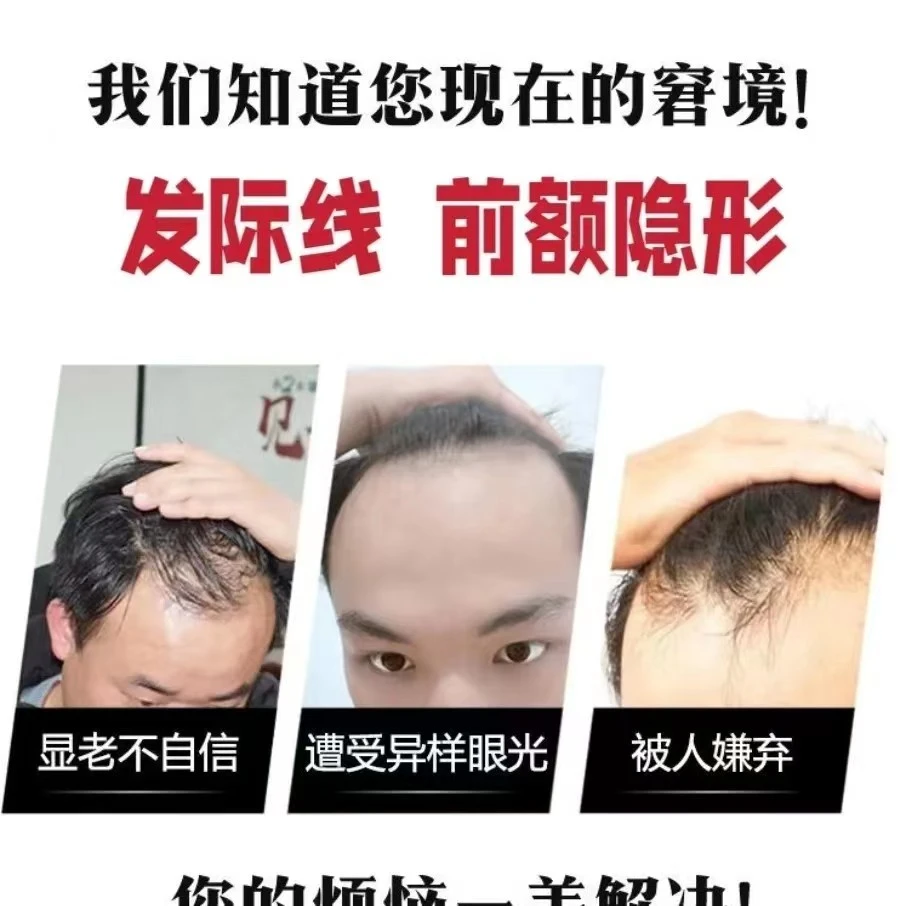 生物头皮发际线隐形补前额刘海可梳背头哪缺补哪真人发全手织无痕