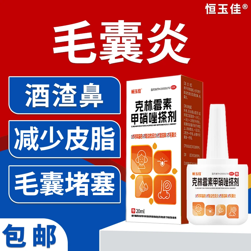 毛囊炎用药克林霉素甲硝唑搽剂20ml前胸痘后背长痘痘马拉色菌毛囊炎疙瘩痤疮脂溢性皮炎寻常痤疮祛痘含克林霉素祛痘正品恒玉佳