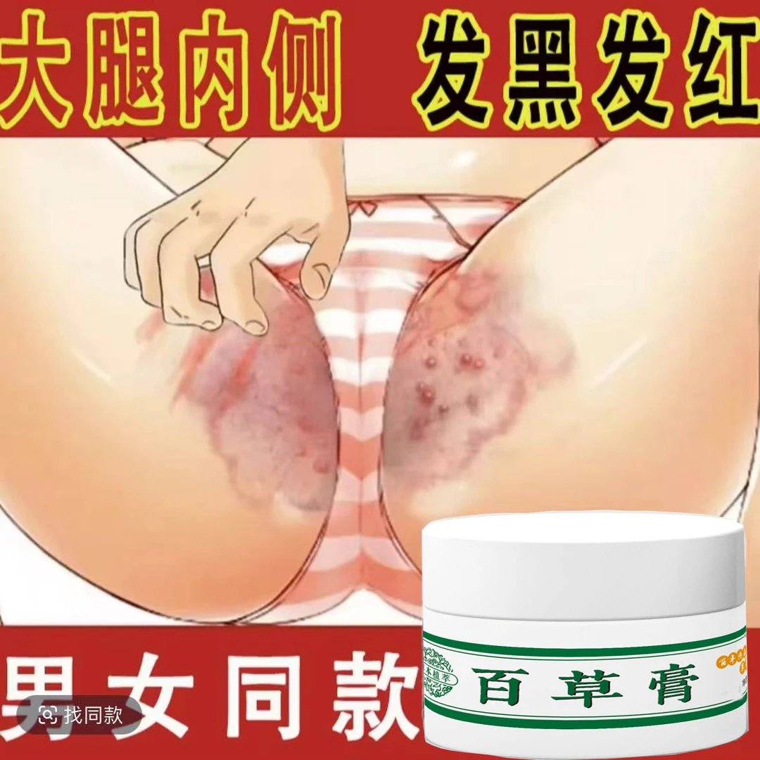大腿内侧阴囊湿痒异味难闻越抓越痒男女同款全身可用草本抑菌软膏